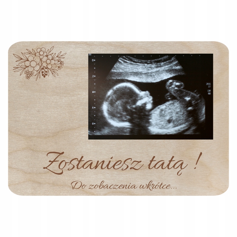 Zostaniesz tatą - informacja o ciąży na zdjęcie usg 3 Zakręcone Sznurki Zostaniesz tatą - informacja o ciąży na zdjęcie usg